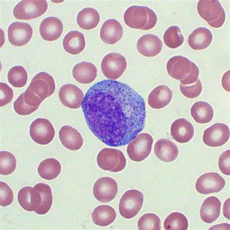 blood test immature granulocytes.